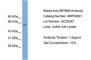 WB Suggested Anti-ZBTB46  Antibody Titration: 0. (ZBTB46 antibody  (Middle Region))