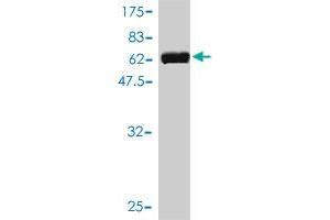 Western Blot detection against Immunogen (51. (UBE2R2 antibody  (AA 1-238))