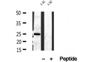 Western blot analysis of extracts of K-562 cells, using PLDN antibody.