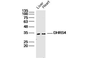 Lane 1: Mouse Liver lysates Lane 2: Mouse Heart lysates probed with DHRS4 Polyclonal Antibody, Unconjugated  at 1:300 dilution and 4˚C overnight incubation.