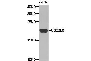Western blot analysis of extracts of Jurkat cell line, using UBE2L6 antibody. (UBE2L6 antibody)
