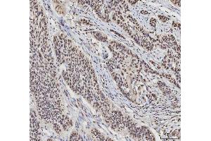 IHC analysis of hnRNP L/HNRNPL using anti-hnRNP L/HNRNPL antibody (ABIN7600130). (HNRNPL antibody  (AA 152-569))