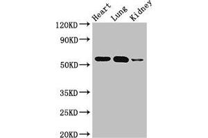 Western Blot Positive WB detected in: Mouse heart tissue, Mouse lung tissue, Mouse kidney tissue All lanes: SMAD5 antibody at 3 μg/mL Secondary Goat polyclonal to rabbit IgG at 1/50000 dilution Predicted band size: 53 kDa Observed band size: 53 kDa (SMAD5 antibody  (AA 1-209))