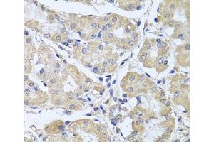 Immunohistochemistry of paraffin-embedded Human stomach using CEP57L1 Polyclonal Antibody at dilution of 1:100 (40x lens).