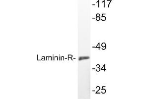 Western blot (WB) analyzes of Laminin-R antibody in extracts from K562 cells. (RPSA/Laminin Receptor antibody)