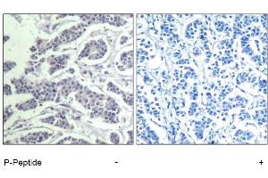Image no. 1 for anti-V-Akt Murine Thymoma Viral Oncogene Homolog 1 (AKT1) (pTyr312), (pTyr315), (pTyr316) antibody (ABIN319270) (AKT1 antibody  (pTyr312, pTyr315, pTyr316))