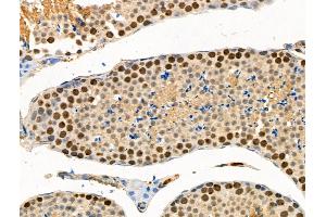 ABIN6256382 and ABIN6267095 at 1/100 staining Mouse testis tissue by IHC-P. (BAP1 antibody  (pSer592))