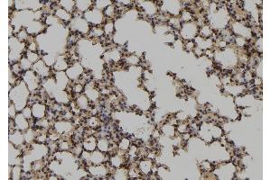 ABIN6278250 at 1/100 staining Mouse lung tissue by IHC-P. (UBE2M antibody  (Internal Region))