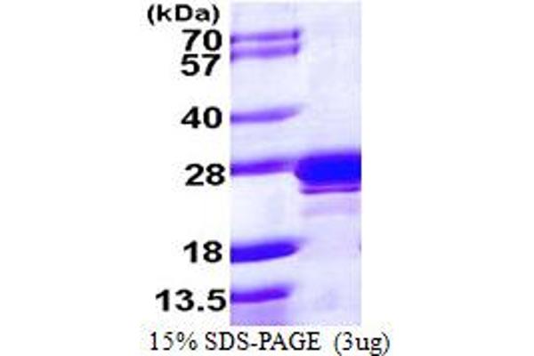 RAB2A Protein (AA 1-212) (His tag)