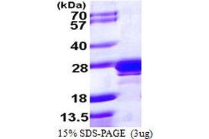 SDS-PAGE (SDS) image for RAB2A, Member RAS Oncogene Family (RAB2A) (AA 1-212) protein (His tag) (ABIN667923) (RAB2A Protein (AA 1-212) (His tag))