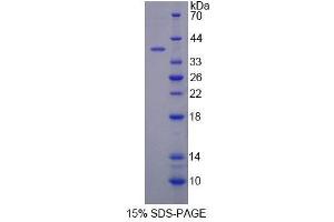 SDS-PAGE (SDS) image for Cytochrome C Oxidase Subunit VIc (COX6C) (AA 1-75) protein (His tag,GST tag) (ABIN4989214) (COX6C Protein (AA 1-75) (His tag,GST tag))
