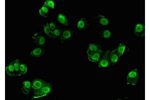 Immunofluorescent analysis of MCF-7 cells using ABIN7169815 at dilution of 1:100 and Alexa Fluor 488-congugated AffiniPure Goat Anti-Rabbit IgG(H+L) (SRGAP1 antibody  (AA 136-192))