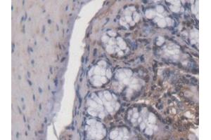DAB staining on IHC-P; Samples: Mouse Colon Tissue (ACD antibody  (AA 21-175))