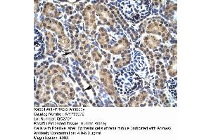 Human kidney (PHKG2 antibody  (N-Term))
