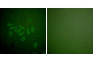 Peptide - +Immunofluorescence analysis of A549 cells, using FHIT antibody (#C0193). (FHIT antibody)