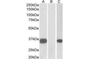 Western Blotting (WB) image for anti-Kv Channel Interacting Protein 3, Calsenilin (KCNIP3) (N-Term) antibody (ABIN1105647) (DREAM antibody  (N-Term))