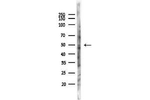 anti-Coagulation Factor X (F10) (C-Term) antibody