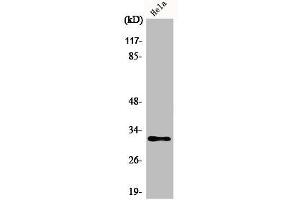 Western Blot analysis of Jurkat cells using AIG-1 Polyclonal Antibody (AIG1 antibody  (C-Term))