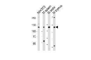 Western blot analysis of lysates from mouse NIH/3T3 cell line, mouse spleen, mouse testis, mouse thymus tissue lysate (from left to right), using Trim24 Antibody (C-term) (ABIN6244019 and ABIN6577664). (TRIM24 antibody  (C-Term))