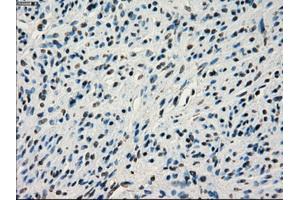 Immunohistochemistry (IHC) image for anti-Interferon Regulatory Factor 3 (IRF3) antibody (ABIN1498899) (IRF3 antibody)