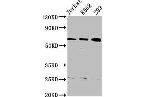 Western Blot Positive WB detected in: Jurkat whole cell lysate, K562 whole cell lysate, 293 whole cell lysate All lanes: ELP3 antibody at 3. (ELP3/KAT9 antibody  (AA 1-85))