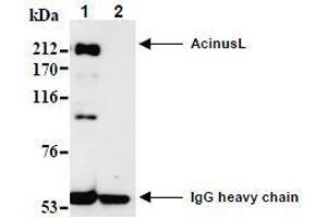 Western Blotting (WB) image for anti-Apoptotic Chromatin Condensation Inducer 1 (ACIN1) (AA 1-523), (N-Term) antibody (ABIN1105223) (ACIN1 antibody  (N-Term))