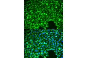 Immunofluorescence analysis of HeLa cells using NFKBIA antibody (ABIN5998337). (NFKBIA antibody)