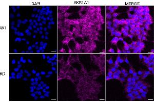 Immunocytochemical staining of HeLa cells using AKR1A1 antibody (ABIN7797569), 1:1,000), Top panel: wild-type (WT), Bottom panal: AKR1A1 shRNA knockdown (KD). (AKR1A1 antibody)