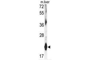 Western blot analysis of DHFR antibody (C-term) in mouse liver tissue lysates (35ug/lane). (Dihydrofolate Reductase antibody  (C-Term))