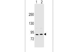 Western blot analysis in MCF-7(lane 1),A375(lane 2) cell line lysates (35ug/lane). (Periostin antibody  (C-Term))