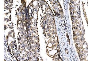 IHC analysis of Sigma1-Receptor/SIGMAR1 using anti-Sigma1-Receptor/SIGMAR1 antibody (ABIN7599011). (SIGMAR1 antibody  (AA 1-154))