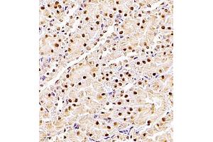 Immunohistochemistry of paraffin embedded rat kidney using ZHX3 (ABIN7076287) at dilution of 1:700 (400x lens)