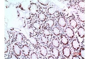 Immunohistochemistry (IHC) analysis of paraffin-embedded Human Colon, antibody was diluted at 1:100. (Tumor Protein p73 antibody  (Tyr221))