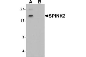 Western blot analysis of SPINK2 in mouse heart tissue lysate with SPINK2 Antibody  at 1 ug/mL in (A) the absence and (B) the presence of blocking peptide.