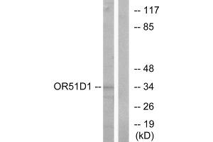 Western blot analysis of extracts from Jurkat cells, using OR51D1 antibody. (OR51D1 antibody  (Internal Region))