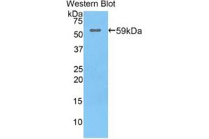 Western blot analysis of the recombinant protein. (LIPC antibody  (AA 191-466))