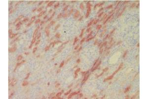 Immunohistochemical analysis of Human L-FABP in Frozen Human kidney tissue using FABP1 Antibody Cat. (FABP1 antibody)