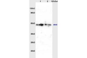 Lane 1: mouse brain lysates Lane 2: mouse embryo lysates probed with Anti phospho-C-Myc(Thr358) Polyclonal Antibody, Unconjugated (ABIN752593) at 1:200 in 4 °C. (c-MYC antibody  (pThr358))