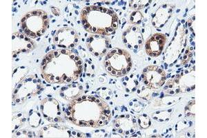 Immunohistochemical staining of paraffin-embedded Human liver tissue using anti-QPRT mouse monoclonal antibody. (QPRT antibody)
