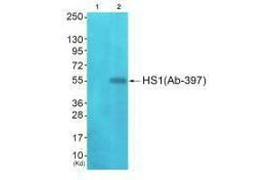 Western blot analysis of extracts from JK cells (Lane 2), using HS1 (Ab-397) antiobdy. (HCLS1 antibody  (C-Term))