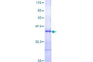 TP53BP1 Protein (AA 1766-1874) (GST tag)