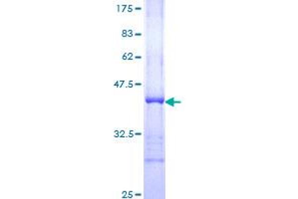 TP53BP1 Protein (AA 1766-1874) (GST tag)