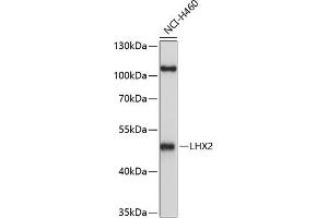 Western blot analysis of extracts of H460 cells, using LHX2 antibody (ABIN6128066, ABIN6143191, ABIN6143192 and ABIN6214989) at 1:1000 dilution. (LHX2 antibody  (AA 337-406))
