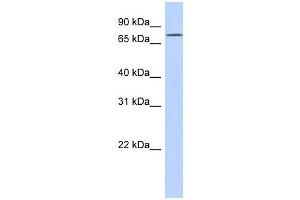 FLJ20433 antibody used at 1 ug/ml to detect target protein.
