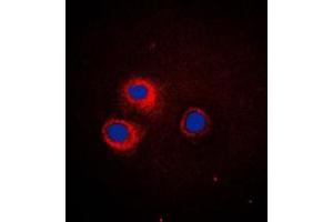 Immunofluorescent analysis of CD1e staining in HeLa cells. (CD1e antibody  (Center))