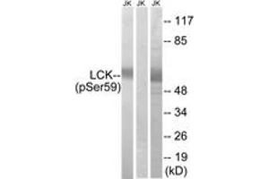 Western blot analysis of extracts from Jurkat cells treated with IFN 2500U/ML 30', using LCK (Phospho-Ser59) Antibody. (LCK antibody  (pSer59))