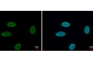 ICC/IF Image Histone H1. (Histone H1.3 antibody  (Center))