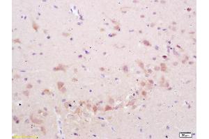 Formalin-fixed and paraffin embedded rat brain labeled with Anti-phospho-STMN2/SCG10 (Ser50) Polyclonal Antibody, Unconjugated (ABIN1714035) at 1:200 followed by conjugation to the secondary antibody and DAB staining (STMN2 antibody  (pSer50))