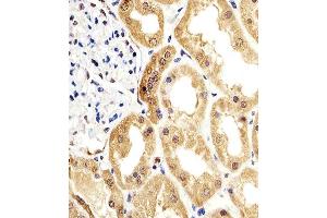 Paraformaldehyde-fixed, paraffin embedded human kidney tissue, Antigen retrieval by boiling in sodium citrate buffer (pH6. (ENO1 antibody)