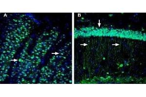 Expression of CD73 in mouse striatum and hippocampus. (CD73 antibody  (Extracellular, N-Term))